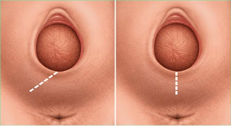 MDAxNTM4MDgzMzEyNzgy.8m8szmj569HewTBrXYdRwb5wkbh6s4fPM3GX2_S4G-Ag.P7ALox2YuC.png?type=w1