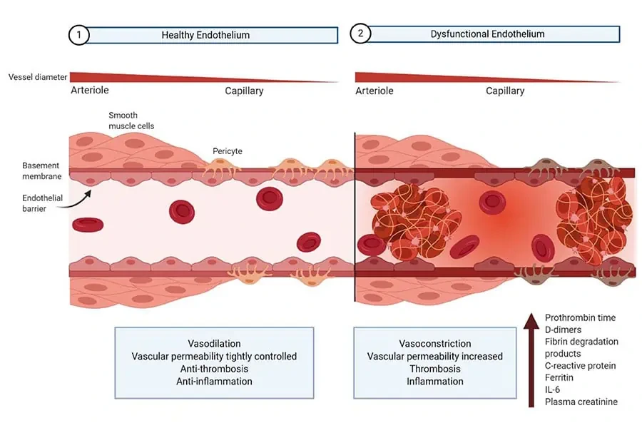 Endothelial-Dysfunction.png?type=w1