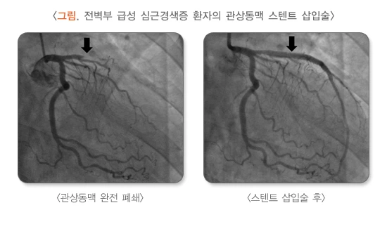 image_(15).png?type=w1