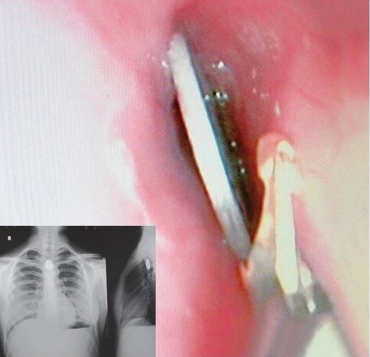 MDAxNTI5NTE2ODUxMjg1.ANHJhh5gwTEqXKpYPCxGIe7LsYOHGEzLFrKKEmtgD3og.fgT3AogTpk.png?type=w1