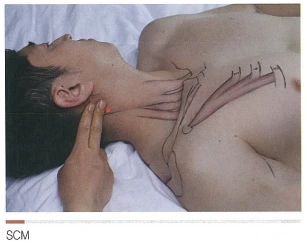 neck-scm1.PNG