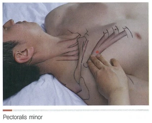 neck-pectoralisminor1.PNG