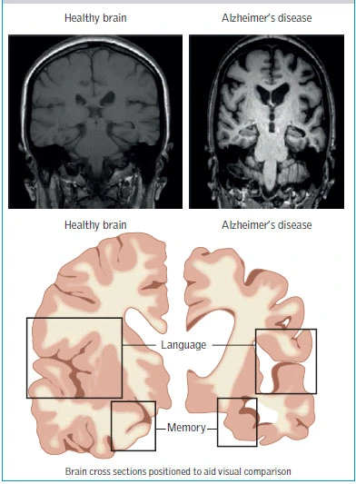 ns_v29_n39_9425_0003.png?type=w1