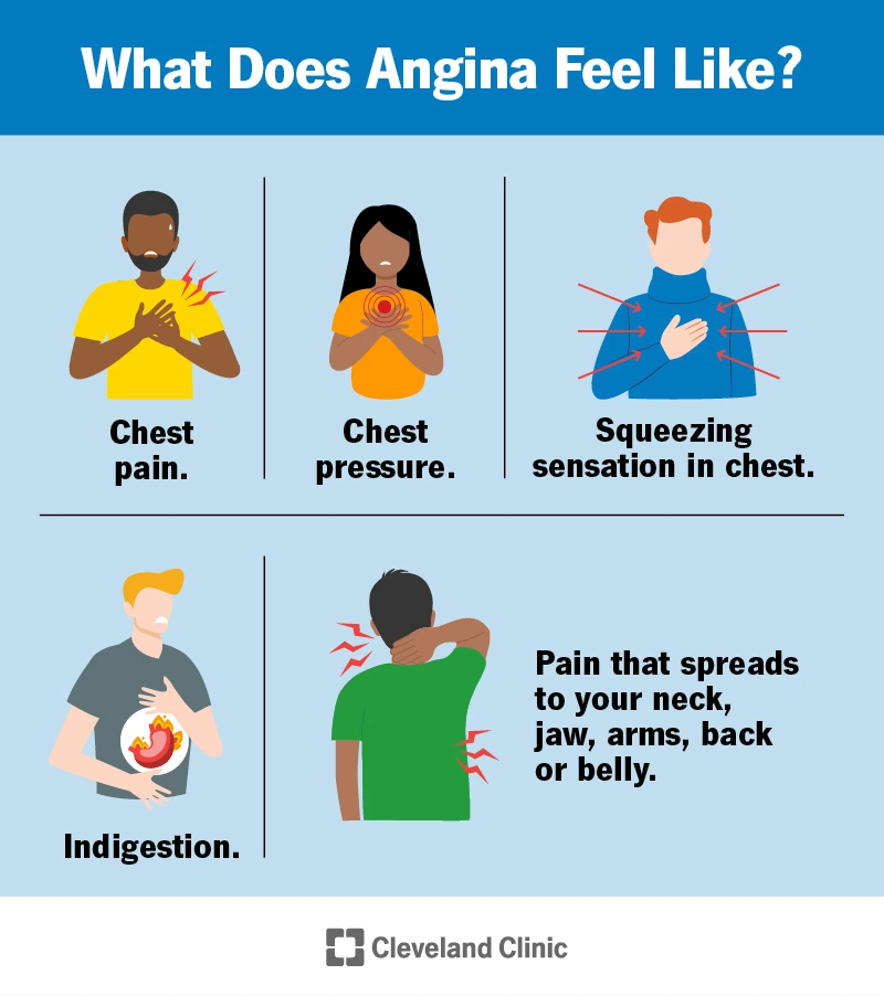 21489-angina.png?type=w1