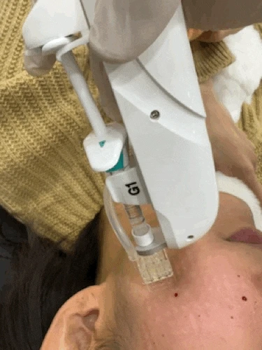 KakaoTalk_20250408_161437965.gif?type=w1