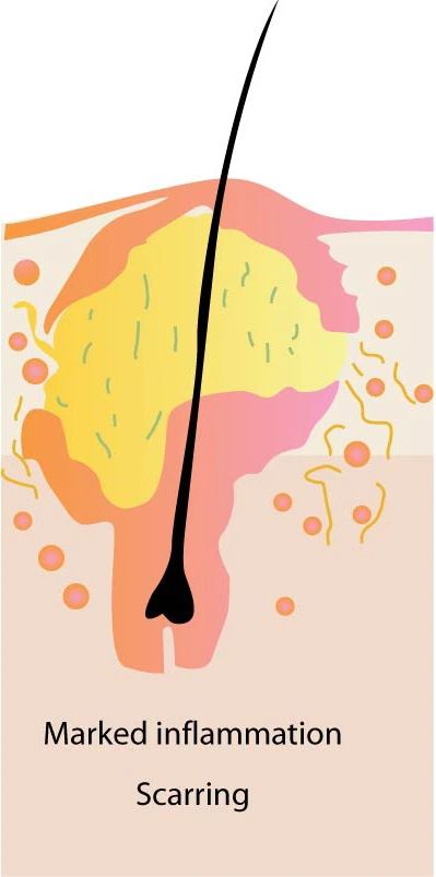 %EC%97%AC%EB%93%9C%EB%A6%84%EB%B9%A8%EB%A6%AC%EC%97%86%EC%95%A0%EB%8A%94%EB%B0%A9%EB%B2%9505.jpg?type=w966