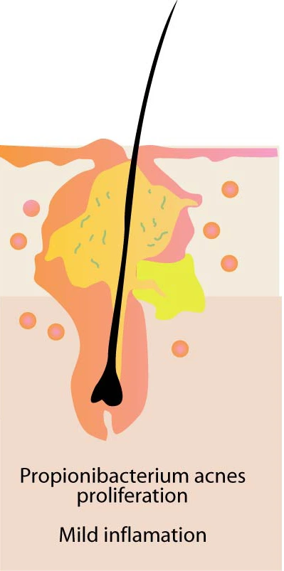 %EC%97%AC%EB%93%9C%EB%A6%84%EB%B9%A8%EB%A6%AC%EC%97%86%EC%95%A0%EB%8A%94%EB%B0%A9%EB%B2%9504.jpg?type=w966