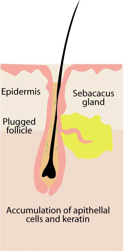 %EC%97%AC%EB%93%9C%EB%A6%84%EB%B9%A8%EB%A6%AC%EC%97%86%EC%95%A0%EB%8A%94%EB%B0%A9%EB%B2%9502.jpg?type=w966