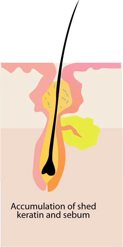 %EC%97%AC%EB%93%9C%EB%A6%84%EB%B9%A8%EB%A6%AC%EC%97%86%EC%95%A0%EB%8A%94%EB%B0%A9%EB%B2%9503.jpg?type=w966