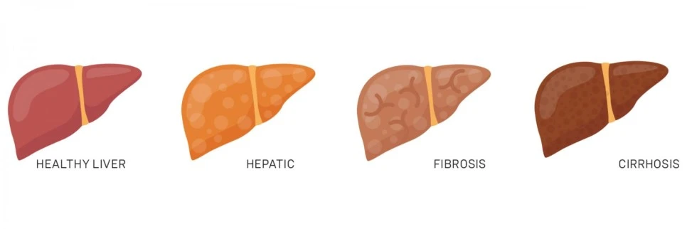 %EA%B0%80%EB%A5%B4%EC%8B%9C%EB%8B%88%EC%95%84%EA%B0%84%EC%86%90%EC%83%8111.jpg?type=w966