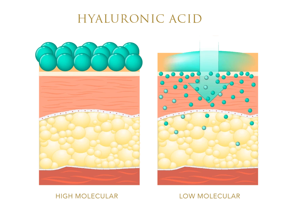 %EB%A8%B9%EB%8A%94%ED%9E%88%EC%95%8C%EB%A3%A8%EB%A1%A0%EC%82%B0%EB%B6%80%EC%9E%91%EC%9A%A904.png?type=w966