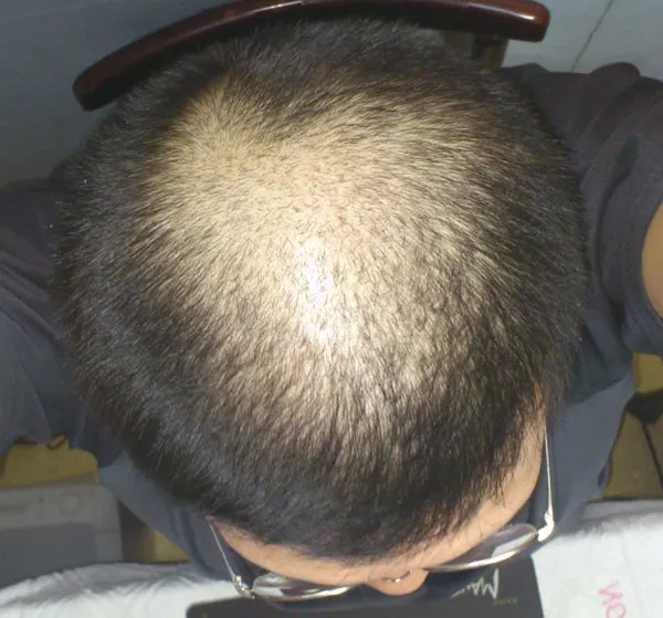 2214D73A55FA0432233116