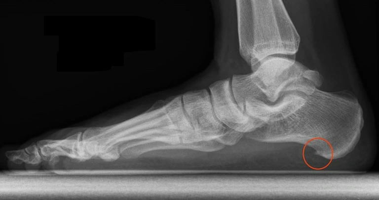 99B4CF33599EF3E72D02DA