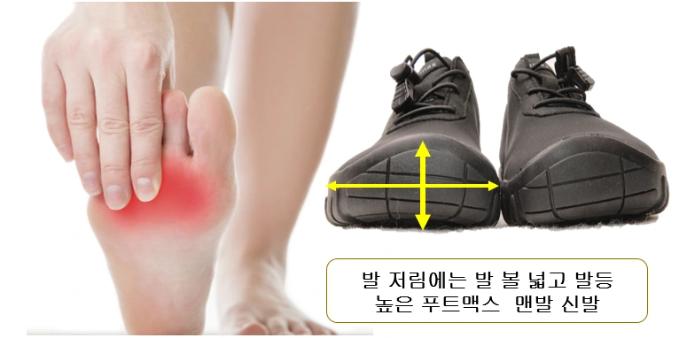 발저림 지간신경종 무지외반증 엄지발가락 푸트맥스 발볼넓은 맨발신발.PNG