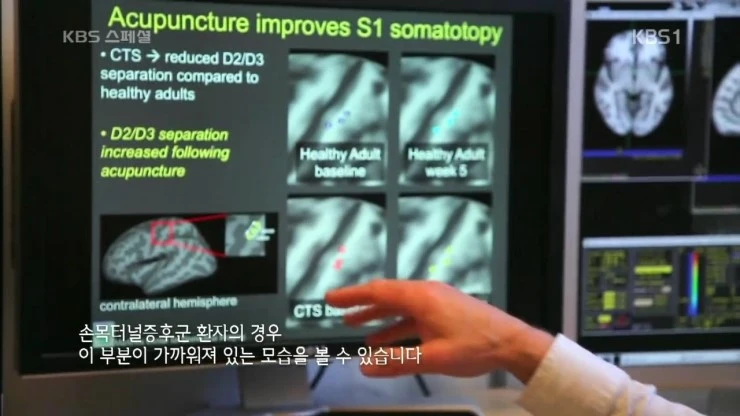 KBS_%BD%BA%C6%E4%BC%C8.160722.%C7%D1%B1%B9%C0%C7_%B0%FA%C7%D0%BF%CD_%B9%AE%B8%ED_%C0%A7%B4%EB%C7%D1_%C0%AF%BB%EA_2%BA%CE_%BC%BC%B0%E8%B0%A1_%C5%BD%B3%BD_%C1%B6%BC%B1%C0%C7_%C0%C7%C7%D0%2C_%B5%BF%C0%C7%BA%B8%B0%A8.HDTV.H264.720p-Unknown.m.jpg?type=w2