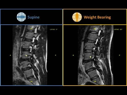 gScanBrio_DiscBulge_10.jpg?type=w2