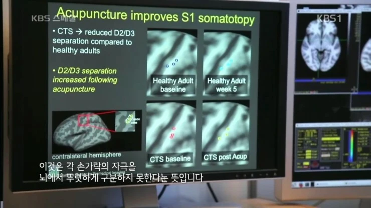 KBS_%BD%BA%C6%E4%BC%C8.160722.%C7%D1%B1%B9%C0%C7_%B0%FA%C7%D0%BF%CD_%B9%AE%B8%ED_%C0%A7%B4%EB%C7%D1_%C0%AF%BB%EA_2%BA%CE_%BC%BC%B0%E8%B0%A1_%C5%BD%B3%BD_%C1%B6%BC%B1%C0%C7_%C0%C7%C7%D0%2C_%B5%BF%C0%C7%BA%B8%B0%A8.HDTV.H264.720p-Unknown.m.jpg?type=w2