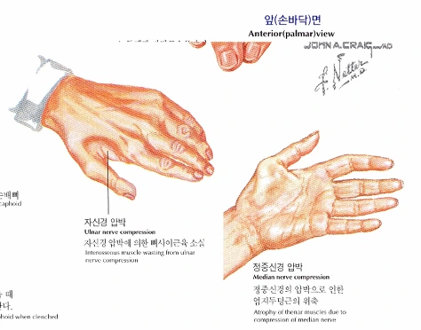 %C1%A6%B8%F1_%BE%F8%C0%BD.png?type=w2