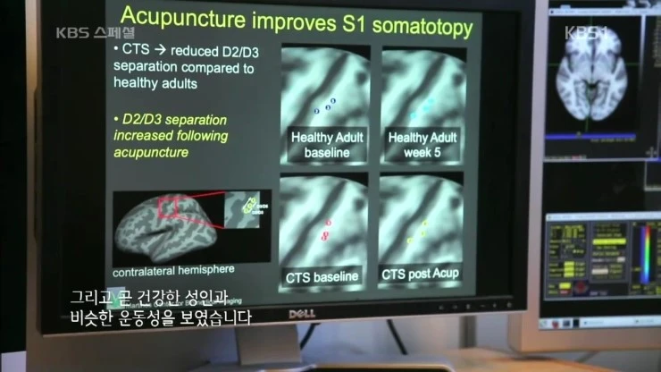 KBS_%BD%BA%C6%E4%BC%C8.160722.%C7%D1%B1%B9%C0%C7_%B0%FA%C7%D0%BF%CD_%B9%AE%B8%ED_%C0%A7%B4%EB%C7%D1_%C0%AF%BB%EA_2%BA%CE_%BC%BC%B0%E8%B0%A1_%C5%BD%B3%BD_%C1%B6%BC%B1%C0%C7_%C0%C7%C7%D0%2C_%B5%BF%C0%C7%BA%B8%B0%A8.HDTV.H264.720p-Unknown.m.jpg?type=w2