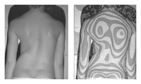 435158.fig.002b.jpg?type=w2