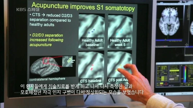 KBS_%BD%BA%C6%E4%BC%C8.160722.%C7%D1%B1%B9%C0%C7_%B0%FA%C7%D0%BF%CD_%B9%AE%B8%ED_%C0%A7%B4%EB%C7%D1_%C0%AF%BB%EA_2%BA%CE_%BC%BC%B0%E8%B0%A1_%C5%BD%B3%BD_%C1%B6%BC%B1%C0%C7_%C0%C7%C7%D0%2C_%B5%BF%C0%C7%BA%B8%B0%A8.HDTV.H264.720p-Unknown.m.jpg?type=w2
