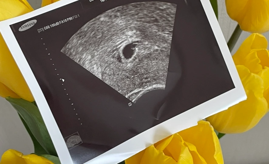 IMG_5097.jpg?type=w1