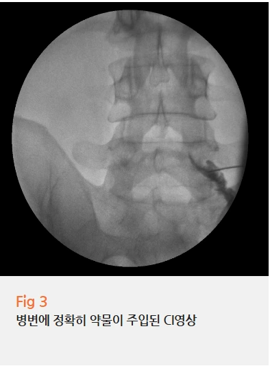 %EA%B7%B8%EB%A6%BC7.png?type=w966