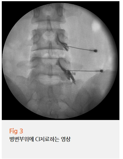 %EA%B7%B8%EB%A6%BC6.png?type=w966