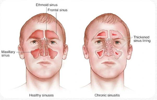 %EA%B7%B8%EB%A6%BC11.png?type=w966