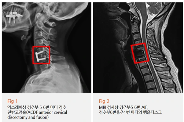 %EA%B7%B8%EB%A6%BC7.png?type=w966
