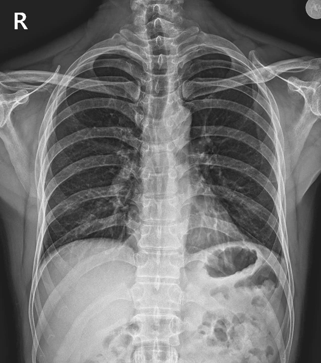 %EA%B7%B8%EB%A6%BC3.jpg?type=w966