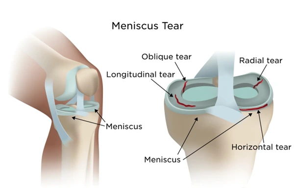 %EA%B7%B8%EB%A6%BC11.png?type=w966