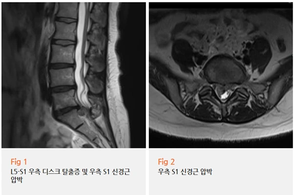 %EA%B7%B8%EB%A6%BC2.png?type=w966