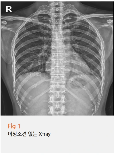 %EA%B7%B8%EB%A6%BC4.png?type=w966