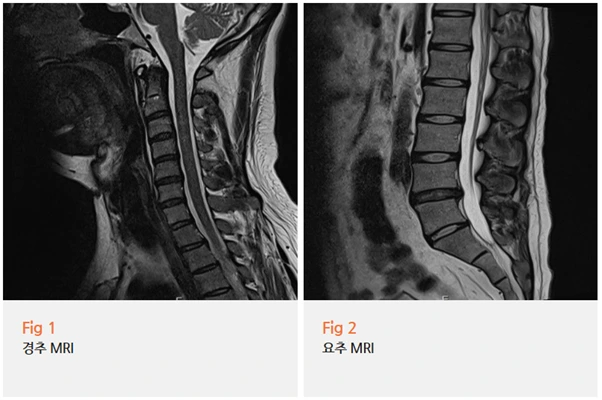 %EA%B7%B8%EB%A6%BC14.png?type=w966