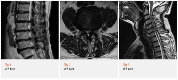 %EA%B7%B8%EB%A6%BC2.png?type=w966