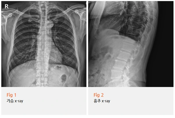 %EA%B7%B8%EB%A6%BC5.png?type=w966