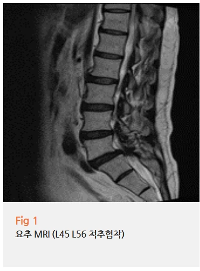 %EA%B7%B8%EB%A6%BC5.png?type=w966