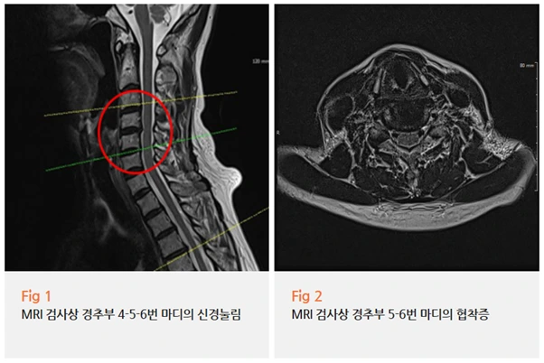 %EA%B7%B8%EB%A6%BC9.png?type=w966