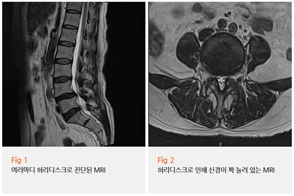 %EA%B7%B8%EB%A6%BC4.png?type=w966