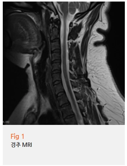 %EA%B7%B8%EB%A6%BC3.png?type=w966