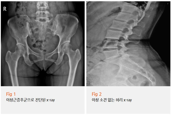 %EA%B7%B8%EB%A6%BC6.png?type=w966