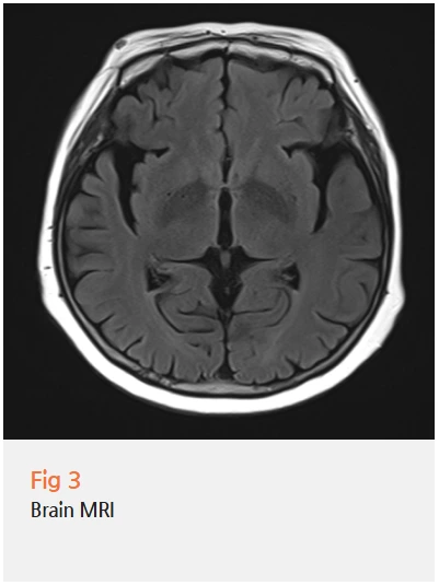 %EA%B7%B8%EB%A6%BC17.png?type=w966