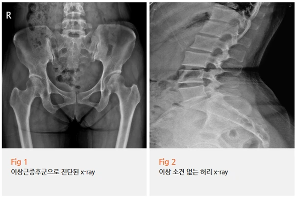 %EA%B7%B8%EB%A6%BC3.png?type=w966