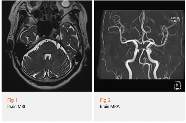 %EA%B7%B8%EB%A6%BC13.png?type=w966