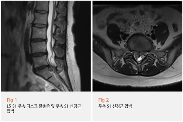 %EA%B7%B8%EB%A6%BC9.png?type=w966