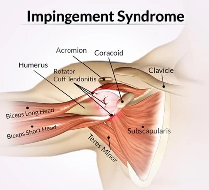 %EA%B7%B8%EB%A6%BC19.jpg?type=w966