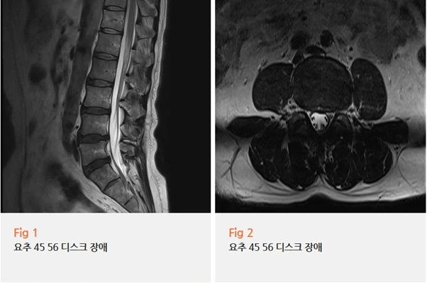 %EA%B7%B8%EB%A6%BC4.png?type=w966