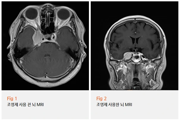 %EA%B7%B8%EB%A6%BC14.png?type=w966