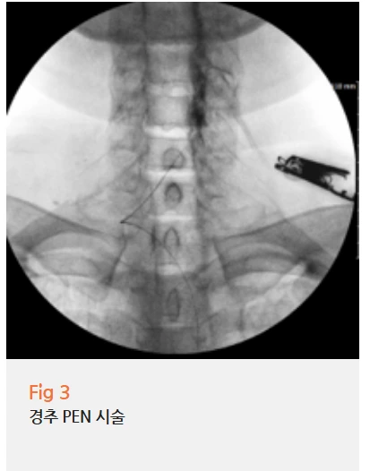 %EA%B7%B8%EB%A6%BC16.png?type=w966